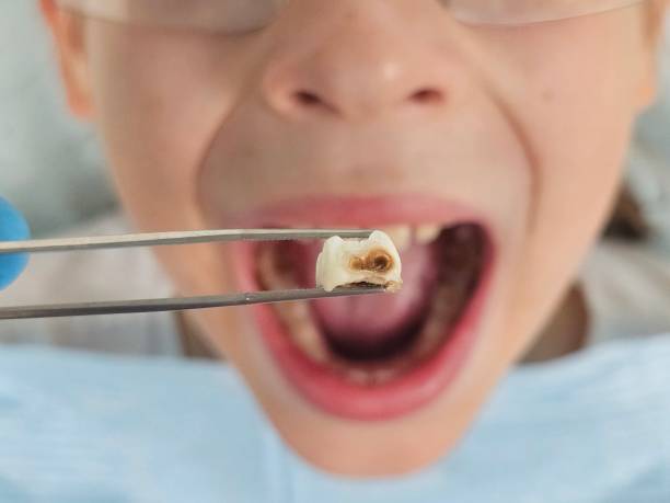 Best Urgent Dental Care for Toothaches in Kalkaska, MI